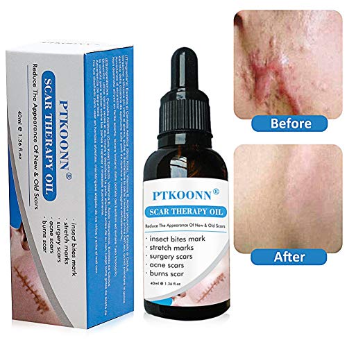 Narben oil,Narben Behandlung,Narben Serum,Scar oil,Reduzieren alten und neuen Narben und Reparieren...